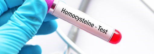  בדיקת הומוציסטאין Homocysteine - תמונה